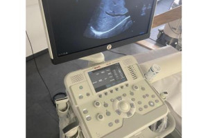 Снимка номер 1 за Esaote MyLab X6 Ultrasound Machine